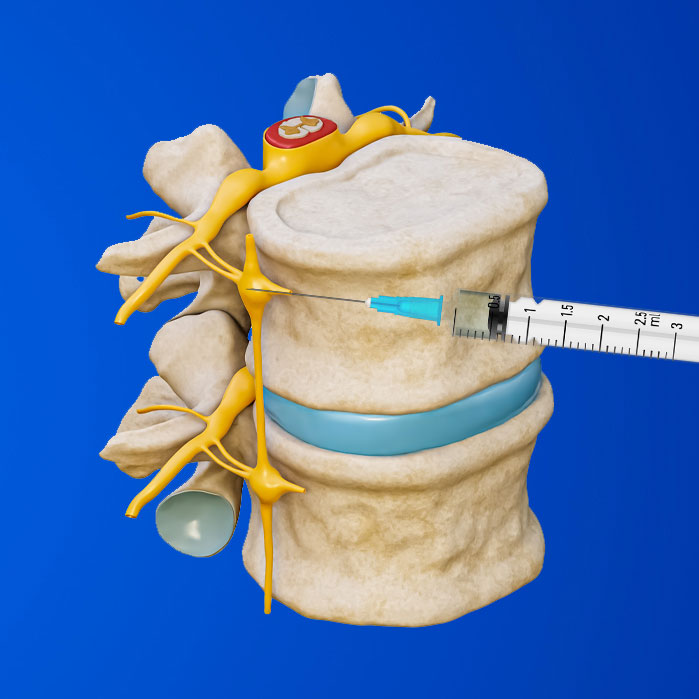 lumbar sympathetic block in Coppell
