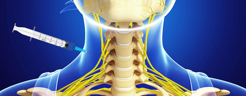 patient receiving Stellate Ganglion Block in Coppell for auto accident injury pain relief
